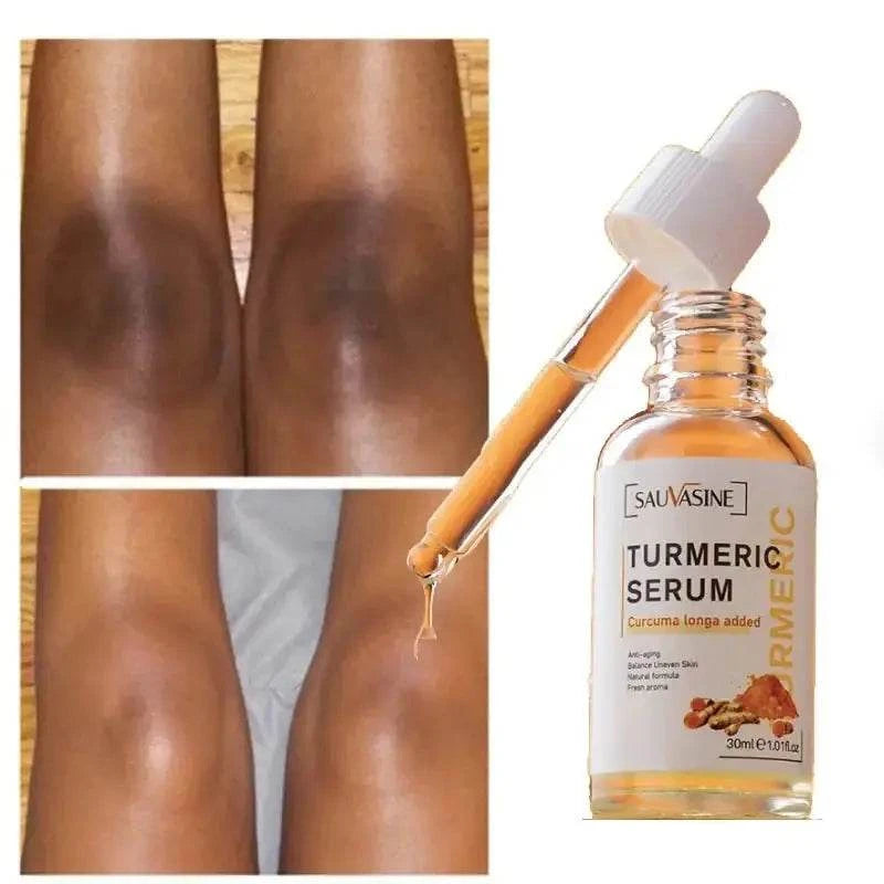 Sérum Natural Glow Curcuma - Solution Éclat Naturel Anti-Imperfections Visage